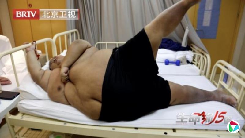 近360公斤内蒙男子刷新中国第一胖纪录