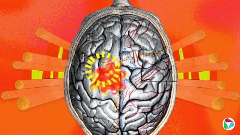 一个大脑的制图