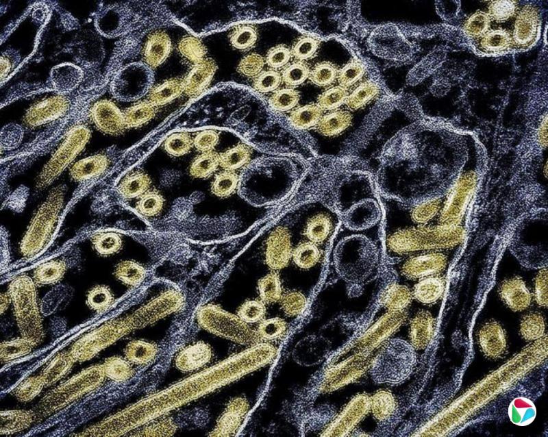 美国报告首例人感染H5N5型禽流感死亡病例